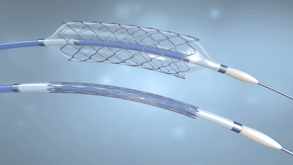 3d rendering of a medical balloon stent and catheter